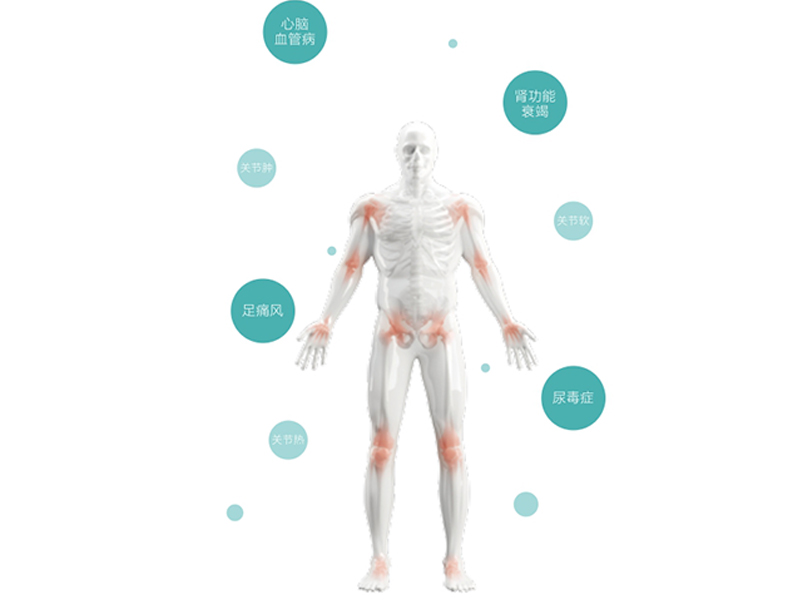 痛風(fēng)個(gè)體化用藥基因檢測(cè)